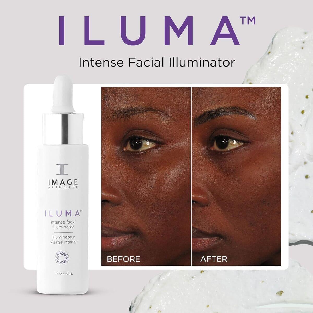 Ілюмінайзер для обличчя Image Skincare Iluma Intense Facial Illuminator, 30 мл